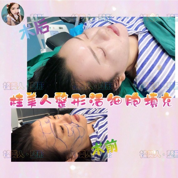 桂美人来了美丽日记