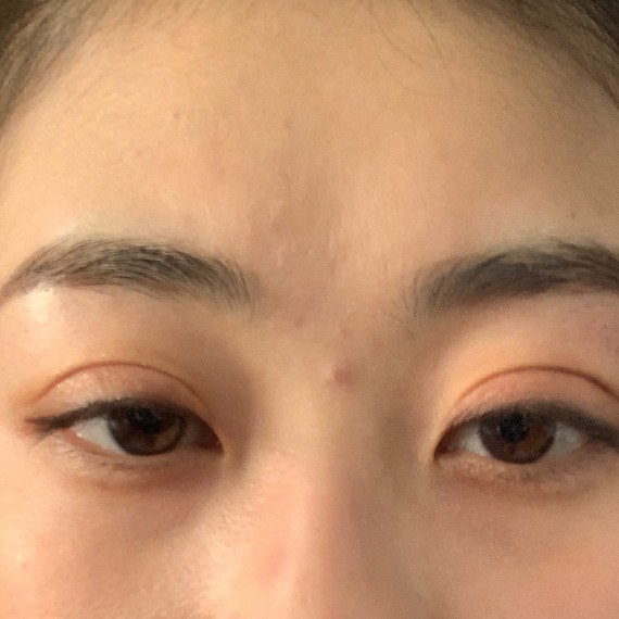 沈阳名流医院失败手术,没有任何说法,只是打过回访电话就音讯全无.