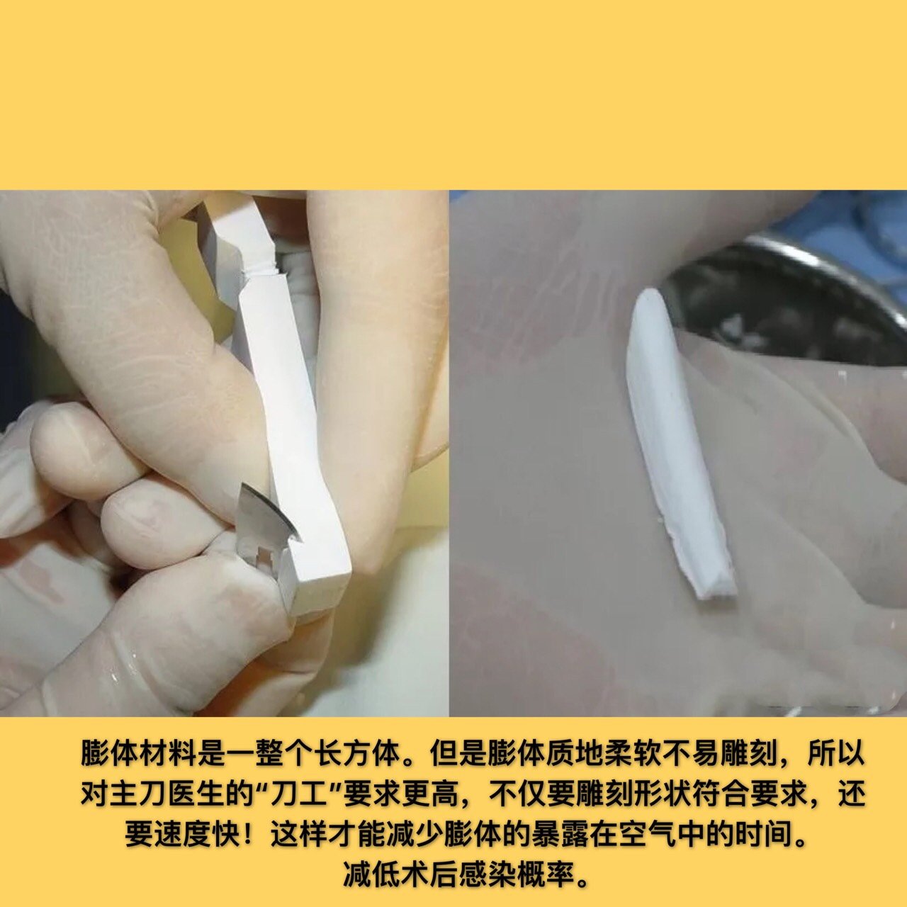 鼻子爱长痘膨体隆鼻会不会感染