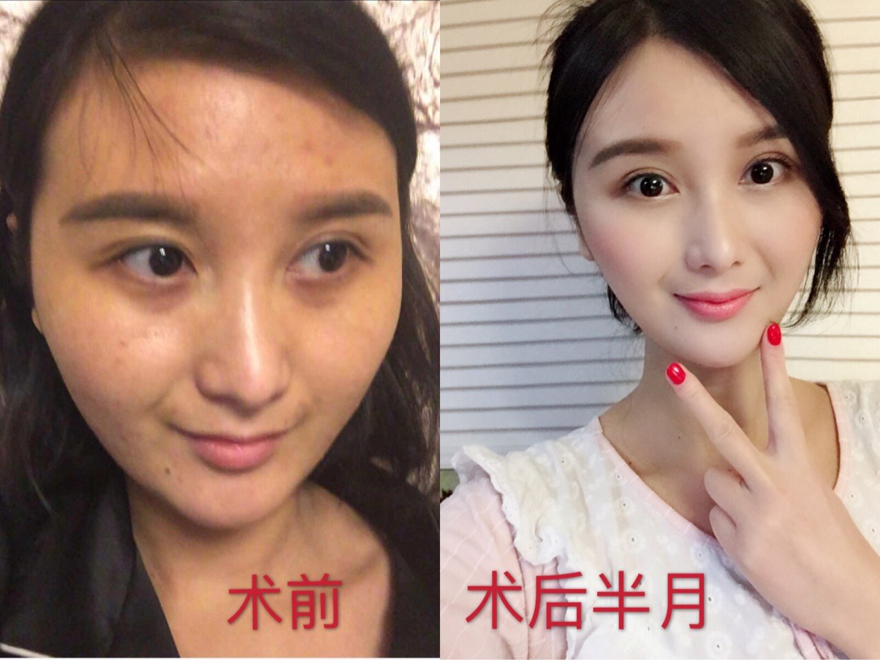天庭饱满,地阁方圆_圈子-新氧美容整形