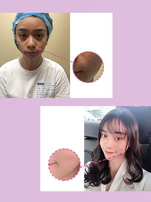 奶萌奶萌的 "松鼠肌"你也有同款吗?