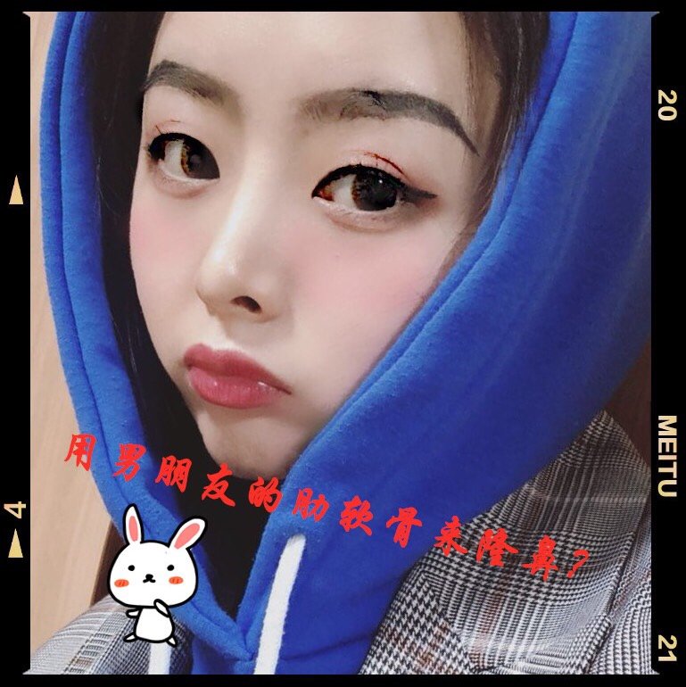 做鼻子用耳软骨还是肋骨做效果好_鼻子用耳软骨好还是肋骨好_鼻子整形耳软骨和肋软骨哪个好