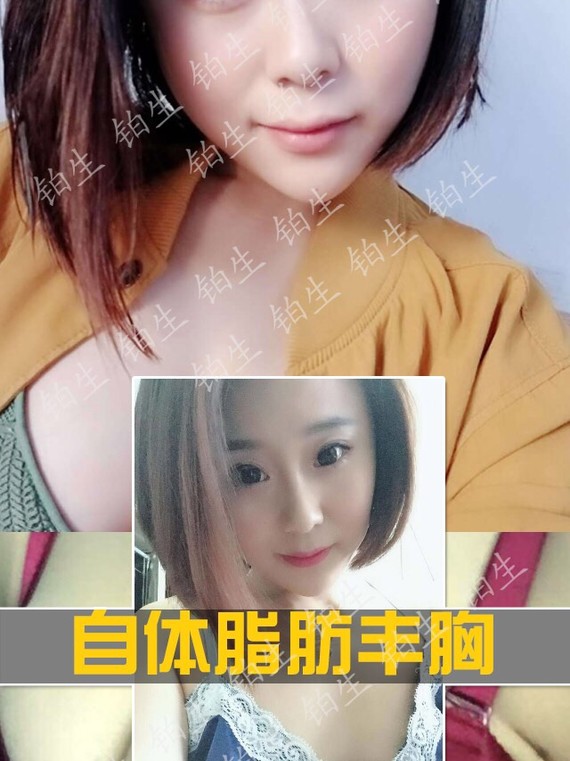 女性經常吃豬蹄可以豐胸嗎?日常有哪些豐胸方法?