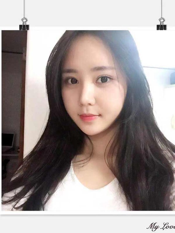 我不就是想割个双眼皮吗亲,你们医院做双眼皮