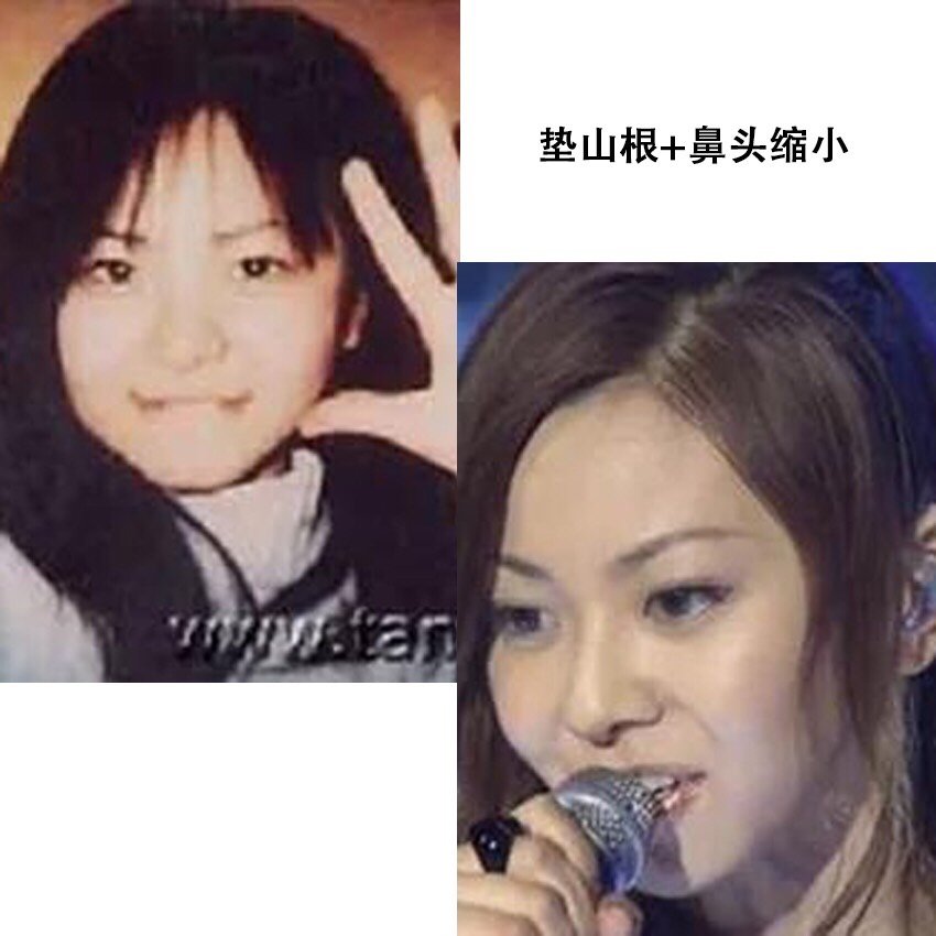 歌姬 归来 是童颜 还是崩坏 长开了还是整容 圈子 新氧美容整形