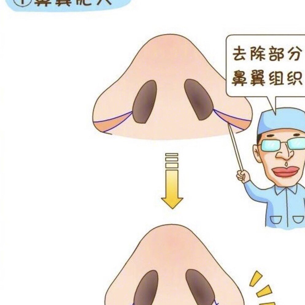 鼻头缩小后增生怎么办