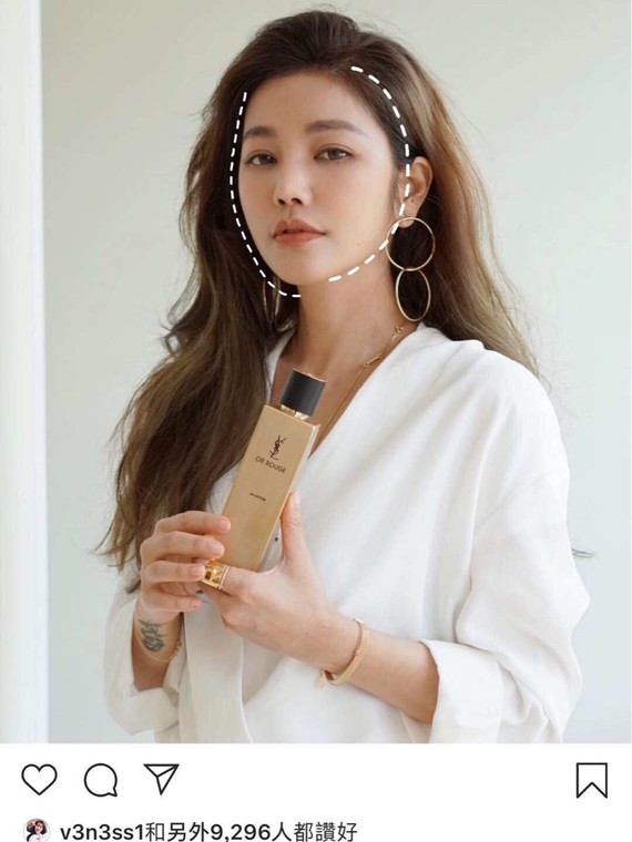 追求自然的脸形绝不会填脂肪的只会微微调整脸