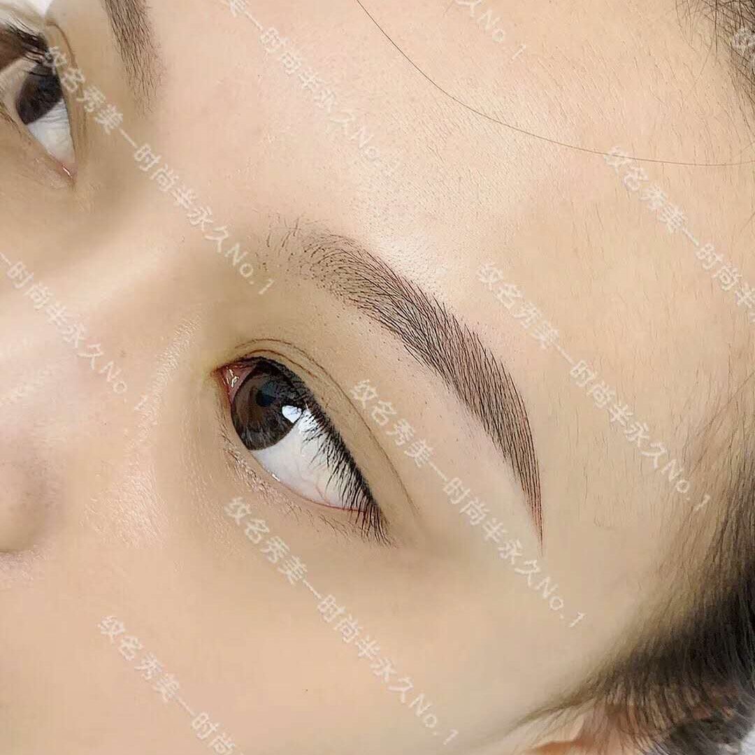 【北京纹名秀美】红底眉改型想要眉毛改型的_圈子-新氧美容整形