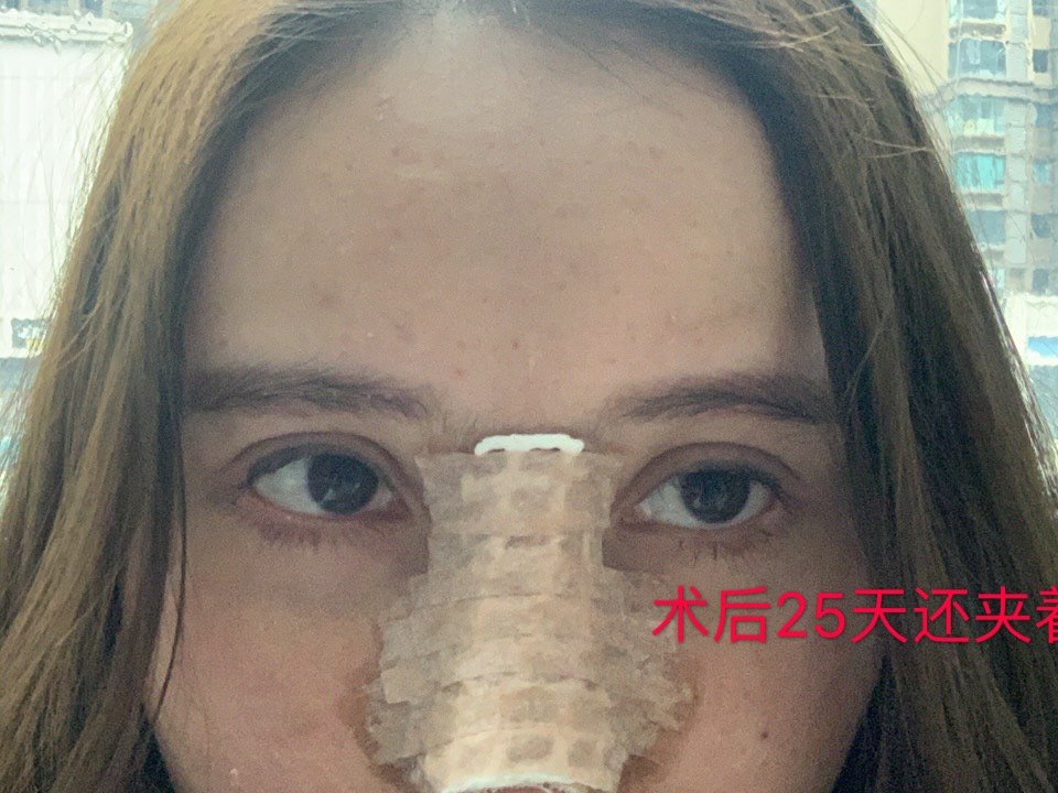 重庆普拉医疗就是黑心整形医院,所谓张尚风教授就是网_圈子-新氧美容