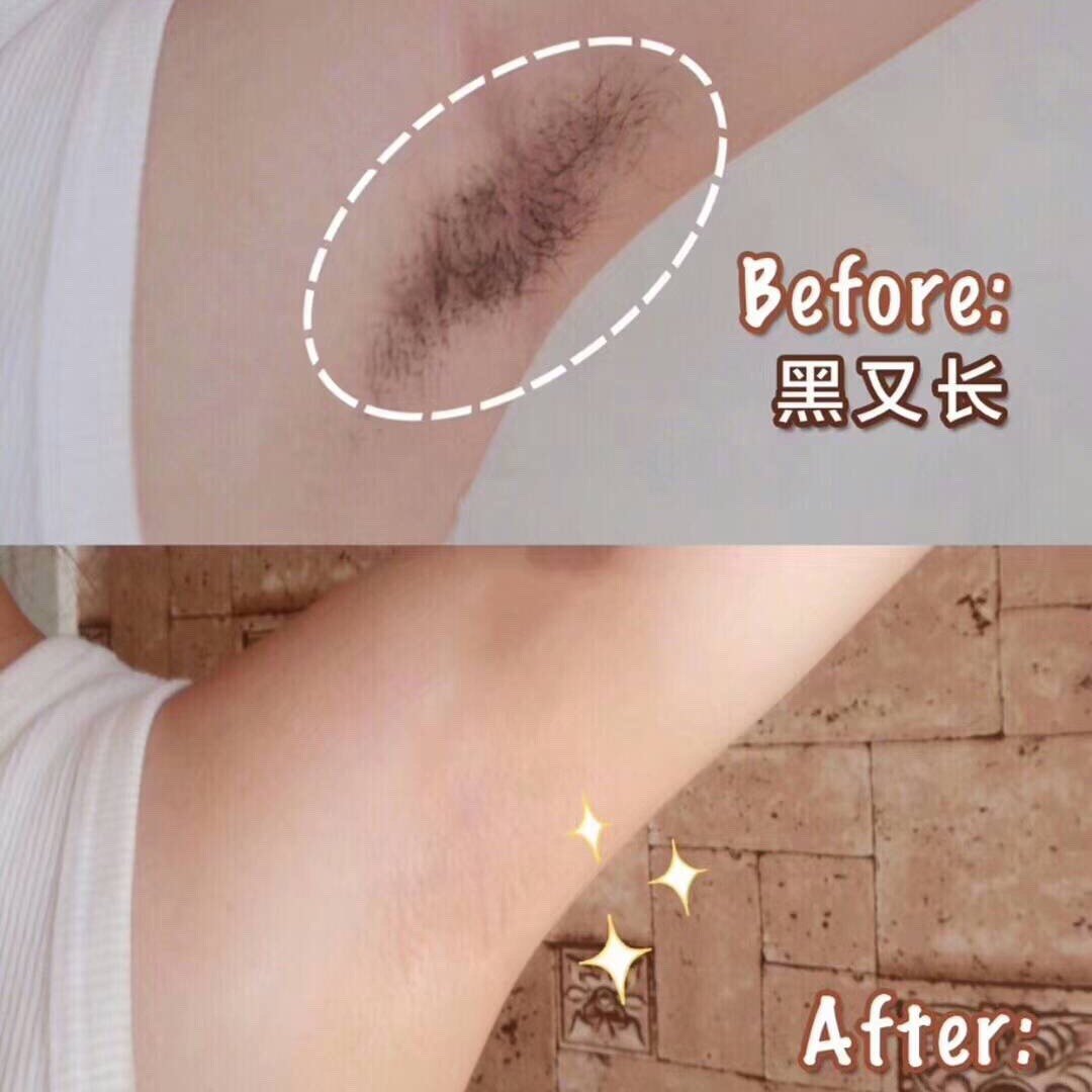 春季脱毛,变身小荔枝