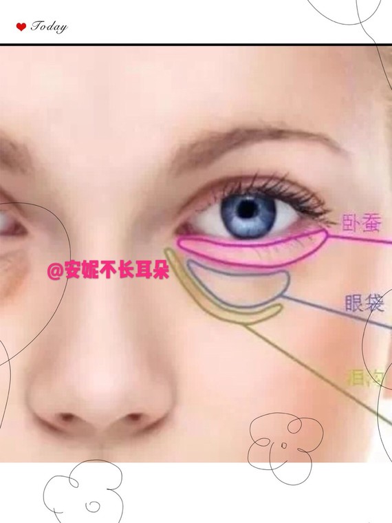 接上篇如何有效的祛眼袋