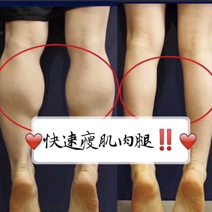 美不美看大腿系列小腿篇(小腿怎么解决?