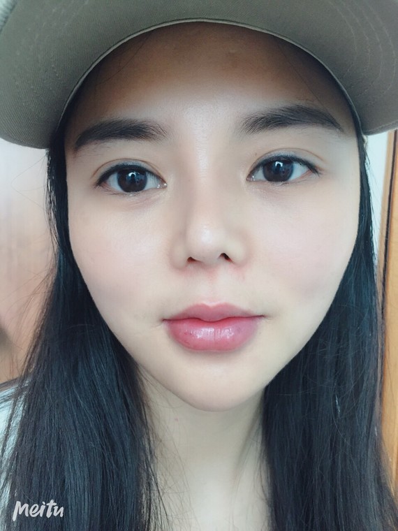 刚做的无针操作嘟嘟唇给点意见吧