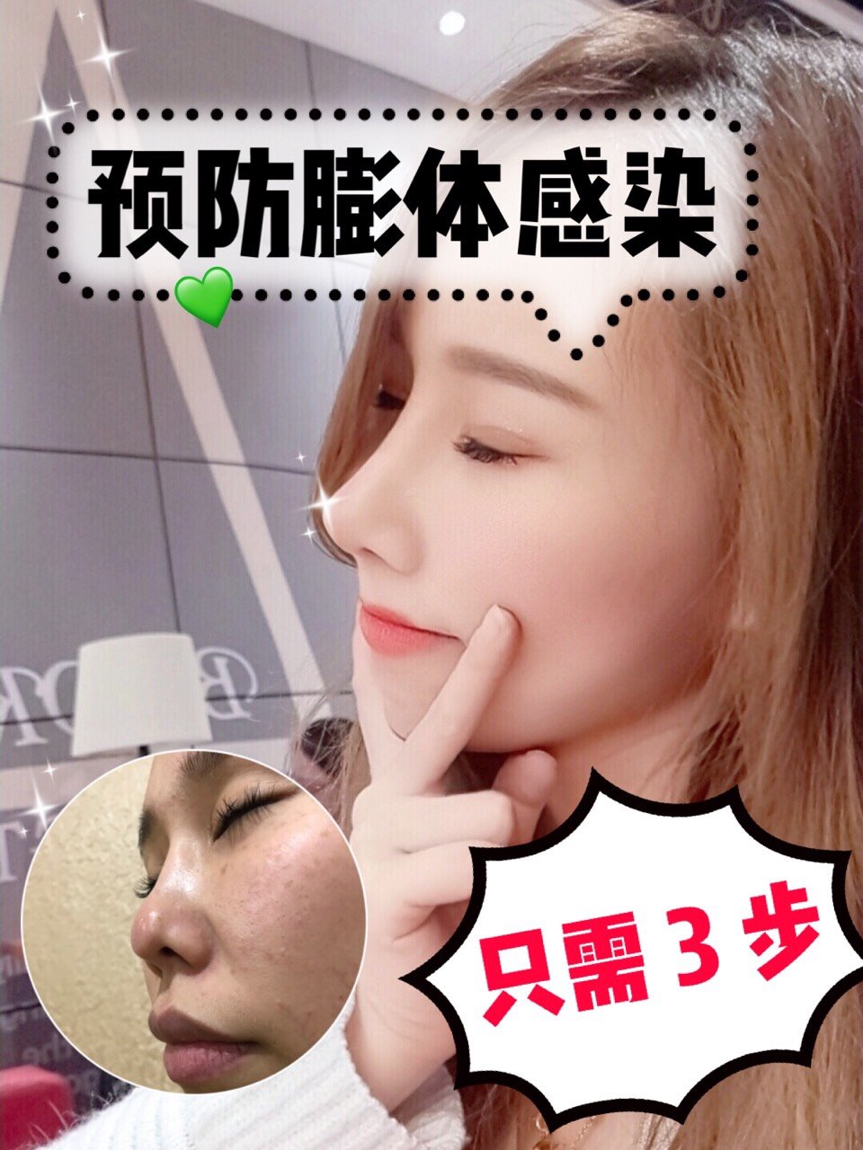 预防膨体感染只需三步