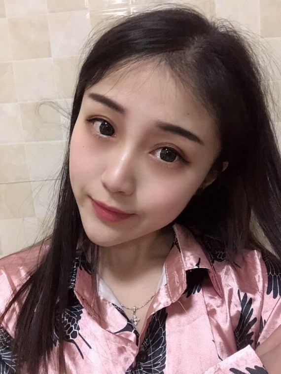 秃顶怎么植发?秃顶人群大部分存在于男士身上