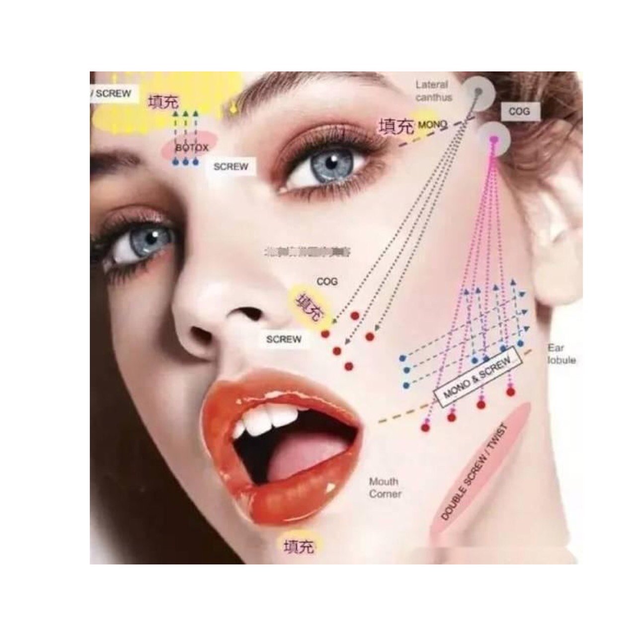 但是线雕里的线也是不同的,分为大v线 小v线,你是否知道他们的不同