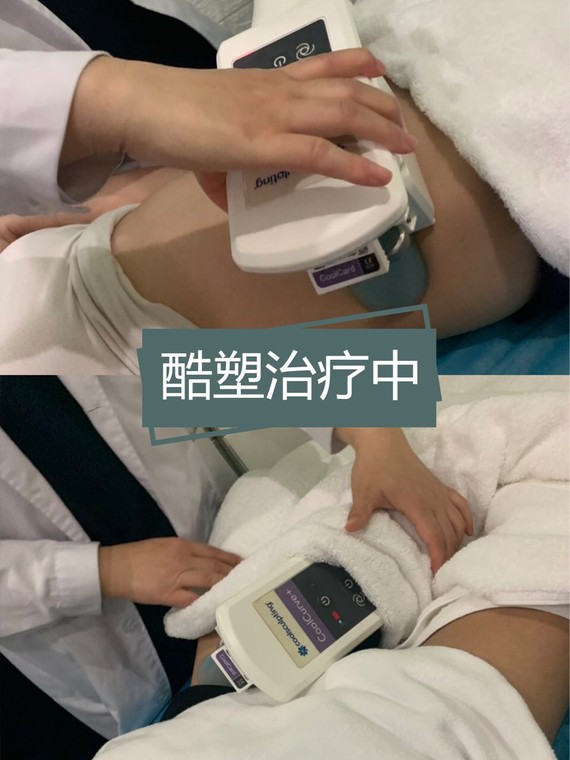 酷塑瘦身|减掉你一直减不掉的肥肉