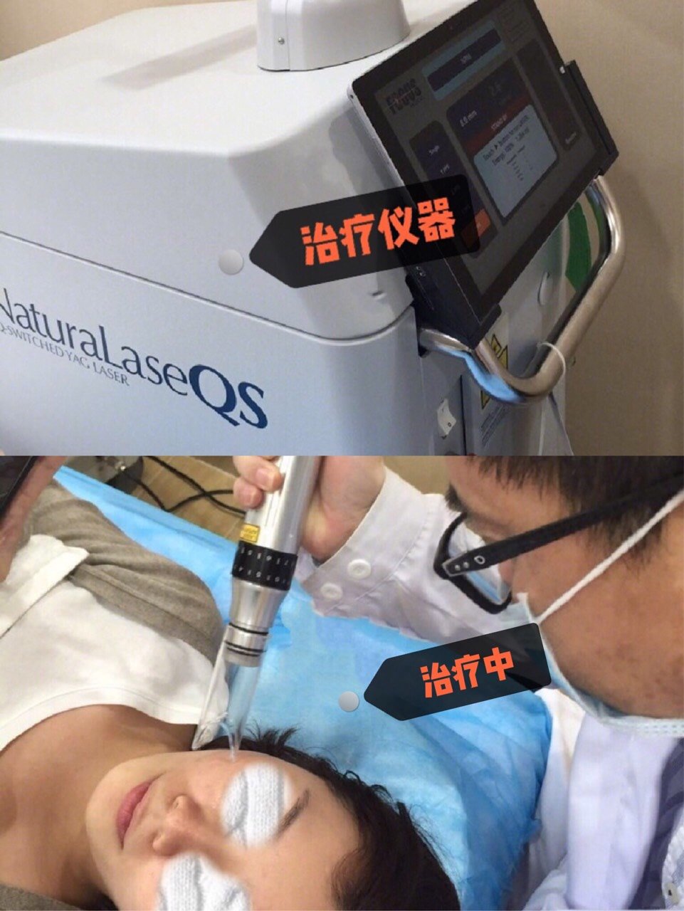 白瓷娃娃初体验