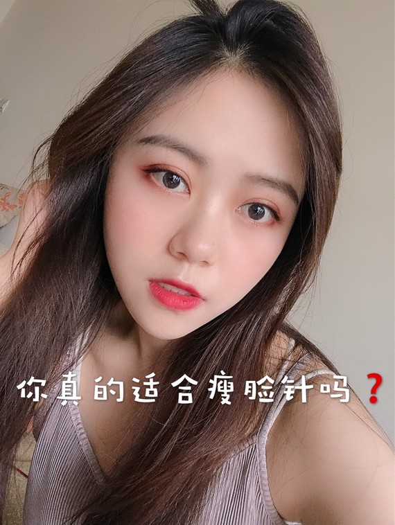 瘦脸针是什么原理?瘦脸针成分是肉毒素,肉毒素