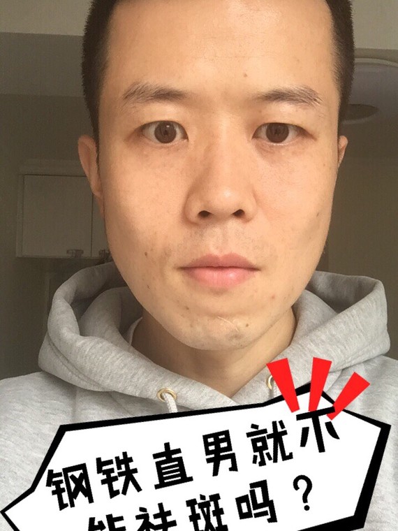 钢铁直男祛斑咋了,花脸不能变净角吗?♂小时