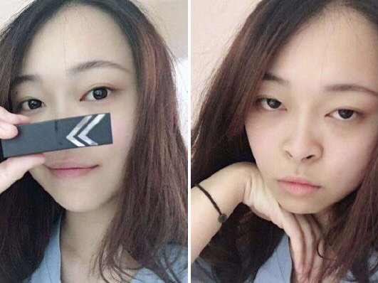 鼻孔外露,面相学认为会"漏财",一个又大又外露的鼻_圈子-新氧美容整形