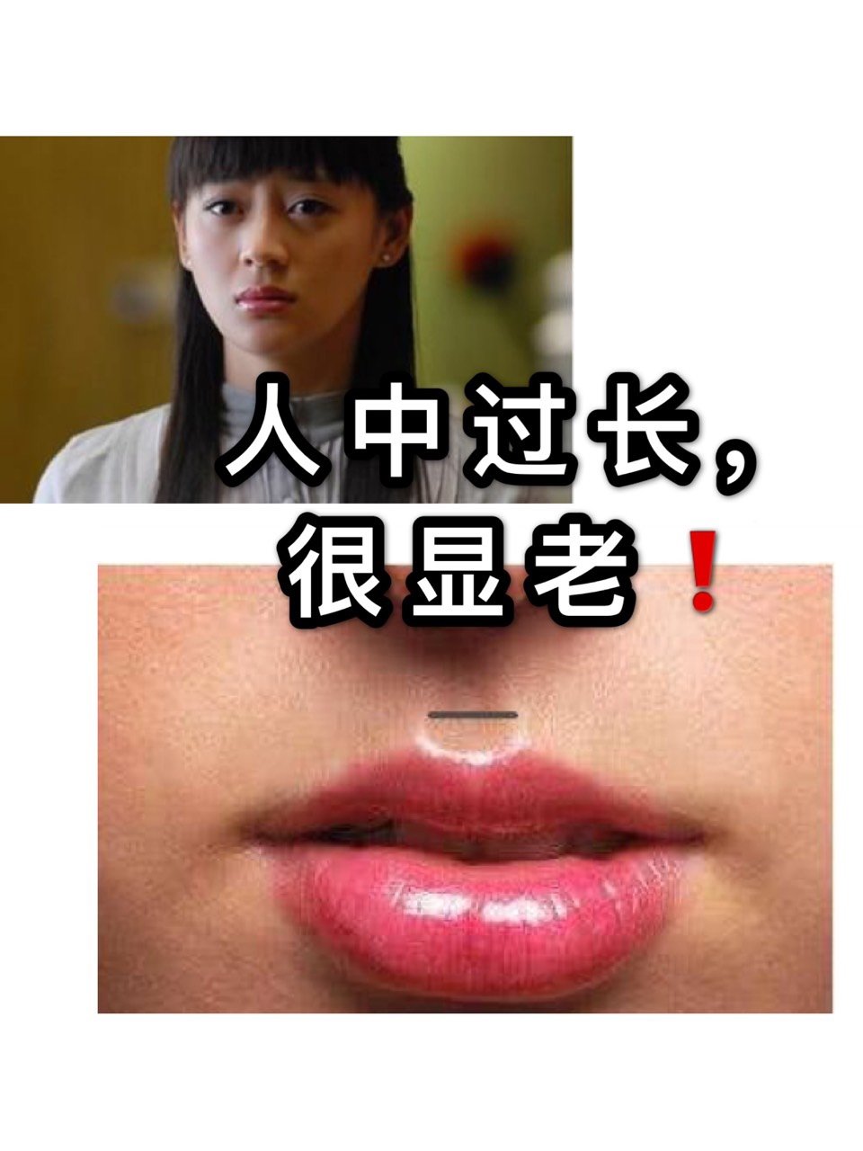 人中过长,很显老