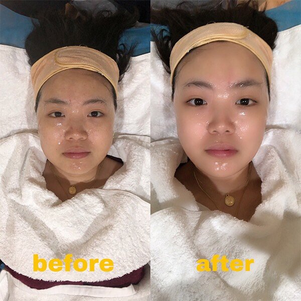 【欧华金宝汇探店·真人分享】我去做了光子嫩肤,结果.