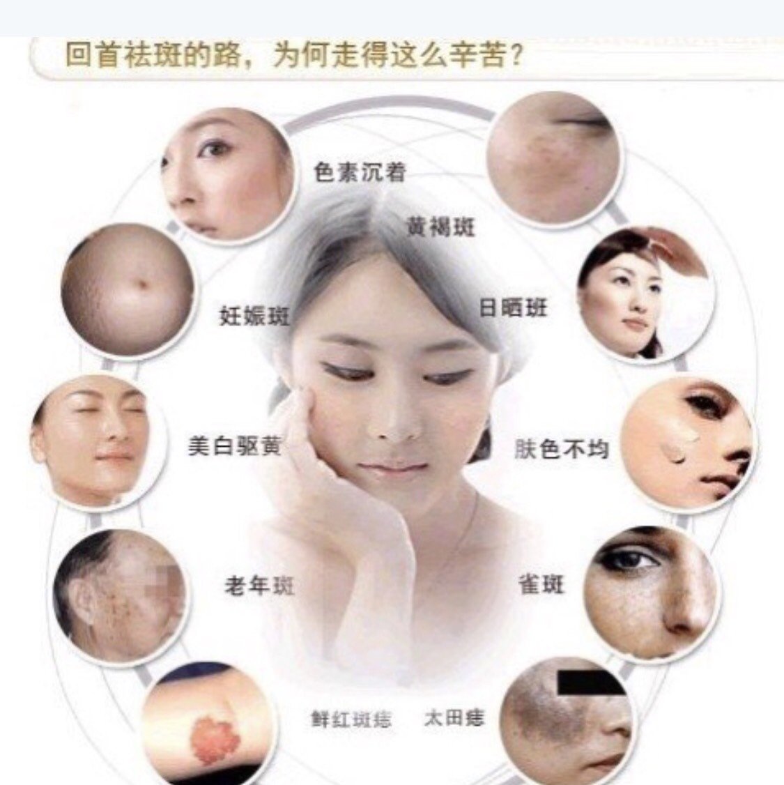 【激光祛斑项目前后注意事项大全】