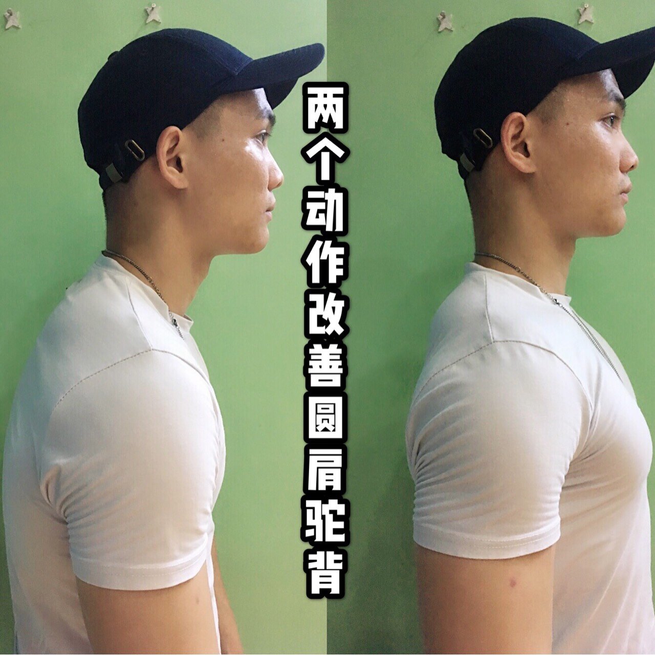 【形体美学】圆肩驼背是现代白领和学生最常见的体态,往往都是因为