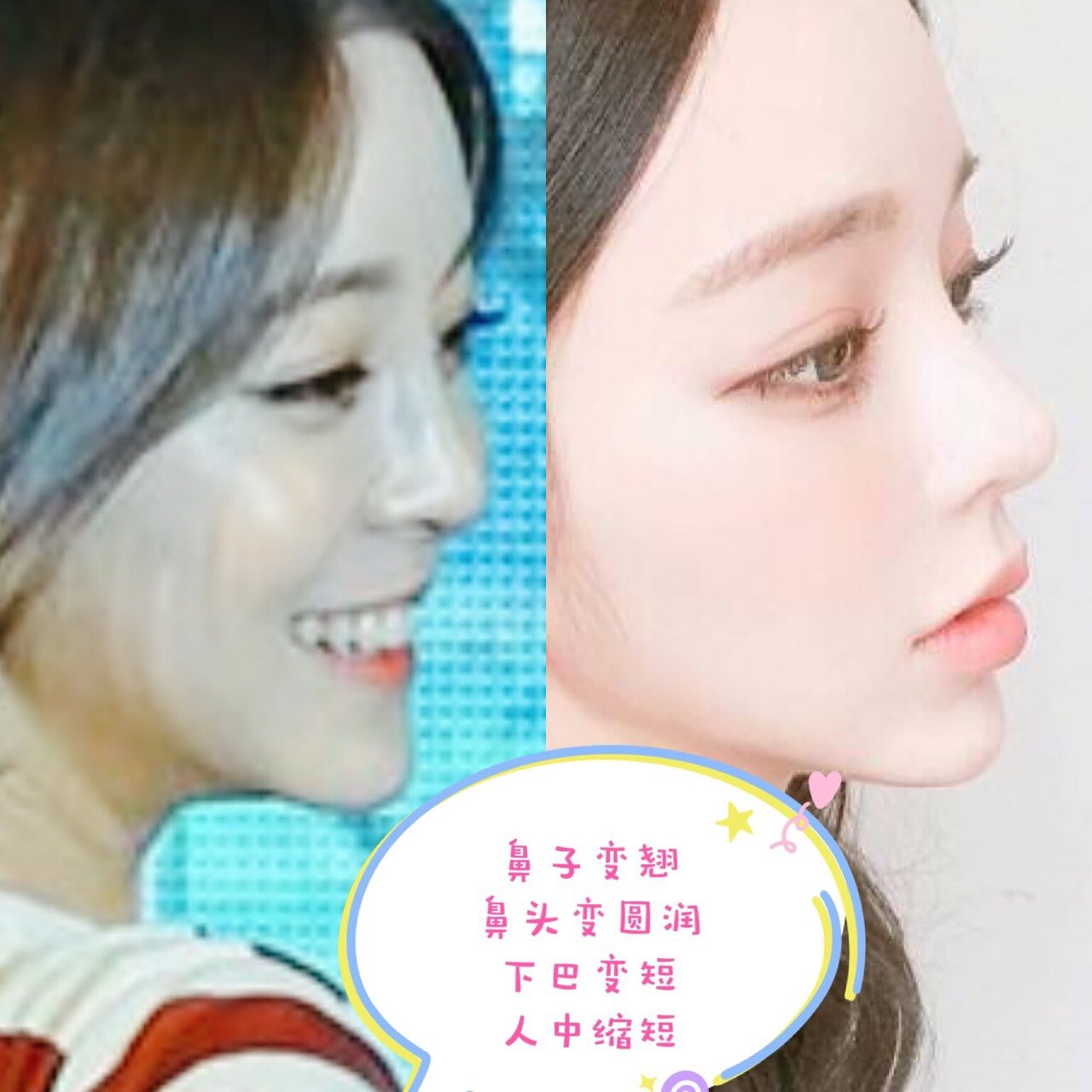 首页 此页面仅支持预览 Avatar 宜采主义 223篇日记 退团改名换头韩国人成为日本人的最新 整形模板 你可能不知道这个 小姐姐叫什么 但你一定在微信好友的头像里 朋友圈封面里 某宝的服装店里 新氧的修图滤镜中见过她 仙女名叫姜泰莉 是93