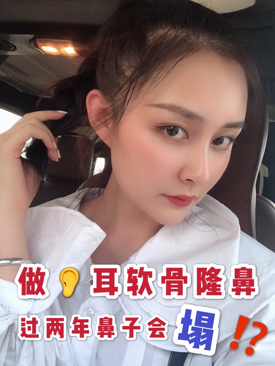 耳软骨隆鼻吧_隆鼻耳软骨隆鼻_耳软骨隆鼻疼吗