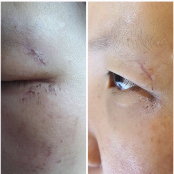 美商提高#93炎炎夏日,吊带热裤比基尼,你就是粉雕_圈子-新氧美容