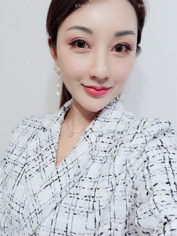 全脸改造整容心得分享变脸史|微整开刀+注射#