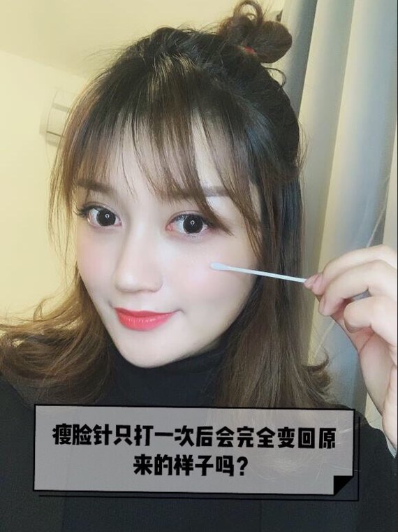 瘦脸针效果保持时间一般可以多久瘦脸针主要是