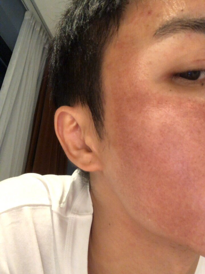 想做激光怕反黑这些都是有方法可以避免的