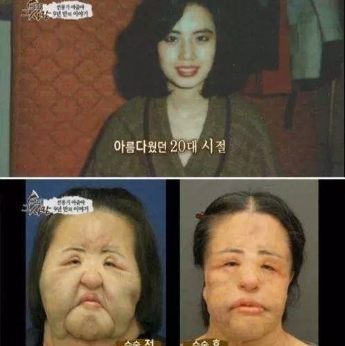 去哪里整形比较好 国内or出国 日本or韩国 圈子 新氧美容整形