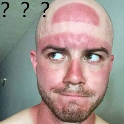 不能删帖是什么情况?百度了半天说网页版可以删_圈子-新氧美容整形