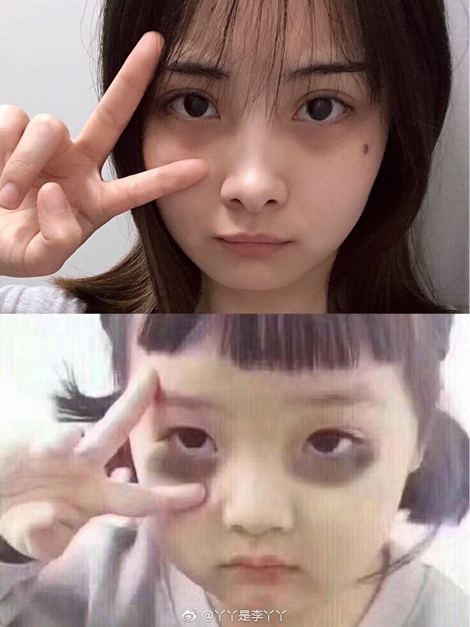 黑眼圈的类别和改善方法