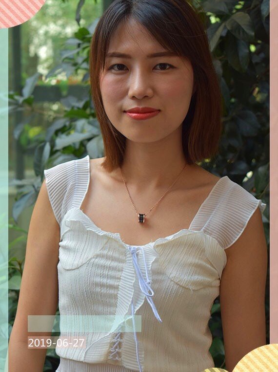 看我的术前照就能看出来我的胸部真的蛮平的,只有a罩杯,除了胸部基础