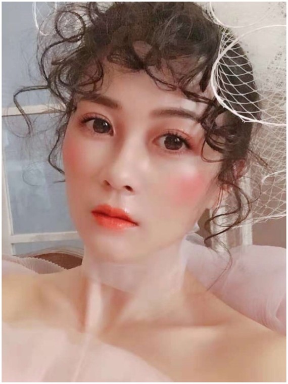 隆鼻手术的切口在哪开在哪里不易留疤很多求美