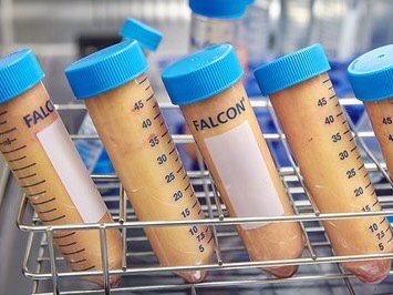 自体脂肪隆胸安全吗?自体脂肪移植隆胸是一种