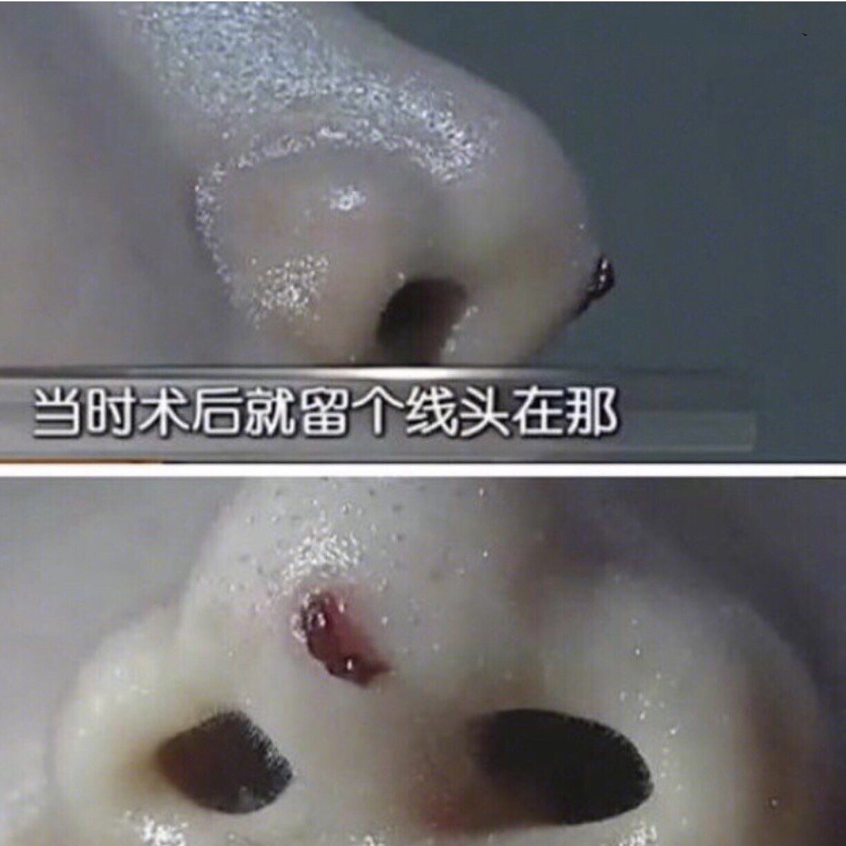 为什么不推荐线雕隆鼻?线雕隆鼻真的有那么好