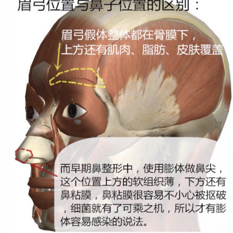 眉弓结构图图片