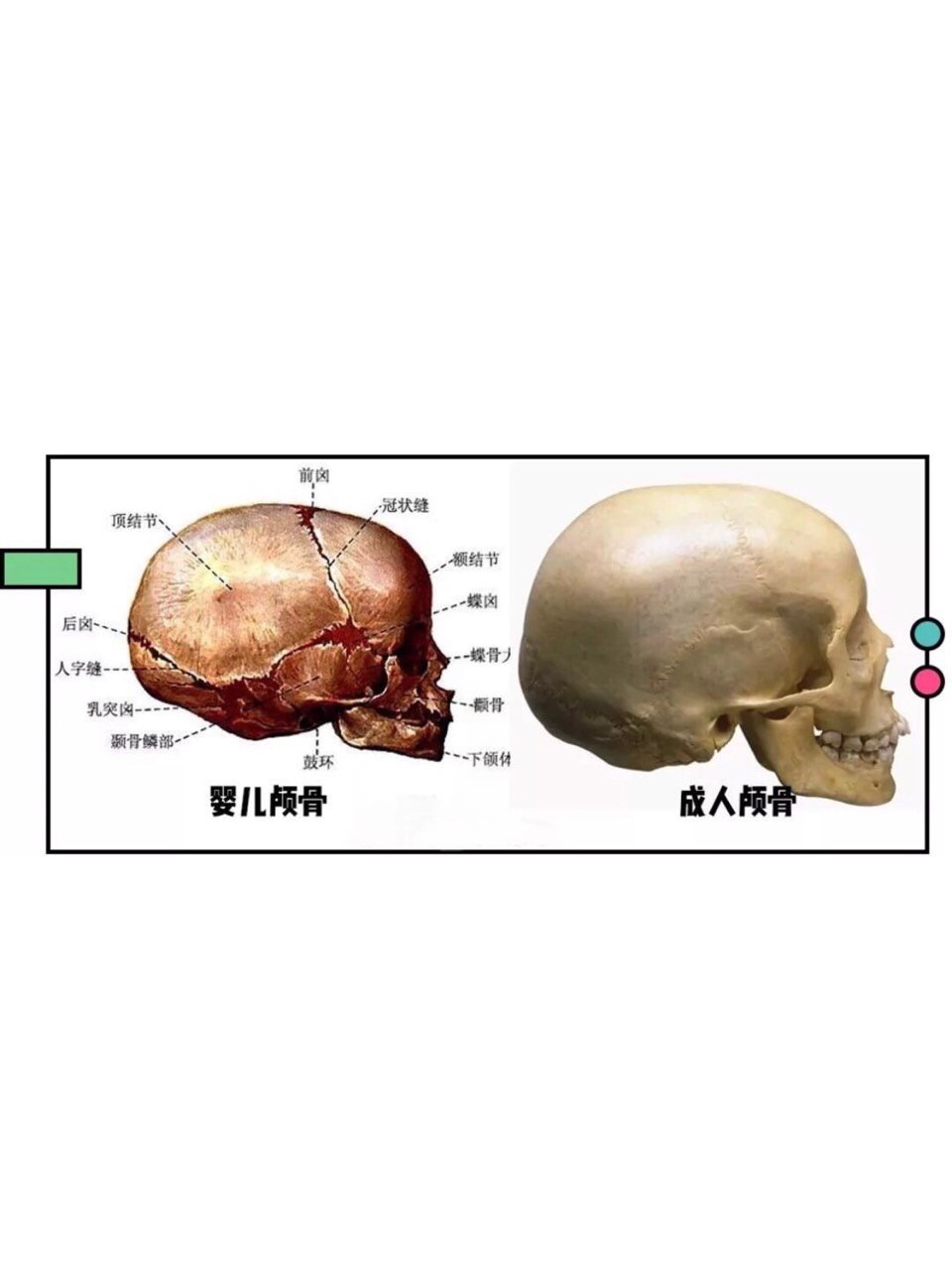 人脸骨架图图片