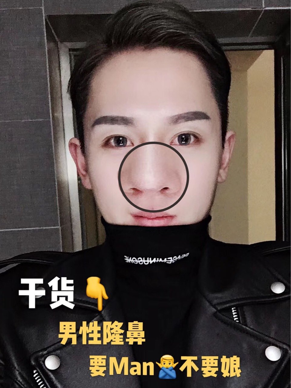 整形早已不是女性的专利,越来越多的男性也纷纷加入了整形大军.