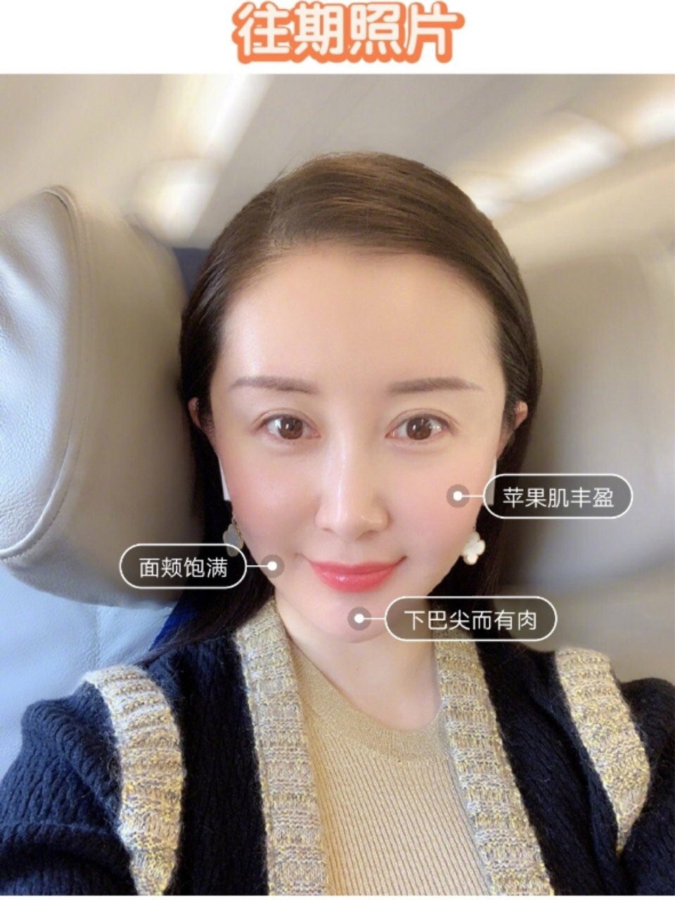 的确,舒畅近照与以前变化较大,有网友猜测是整容过度,也有猜测是死舷