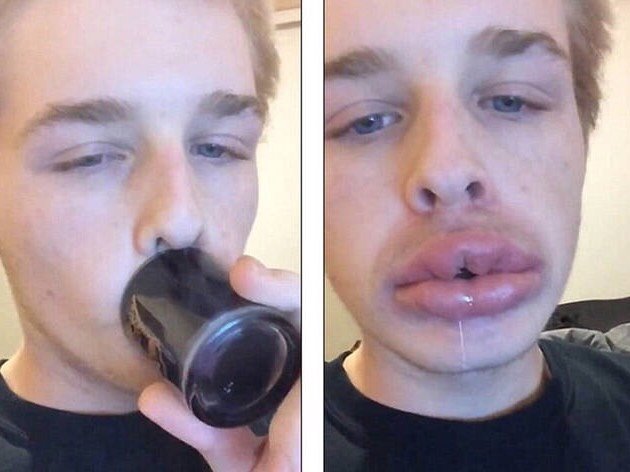 嘴对着杯子一吸就能丰唇?