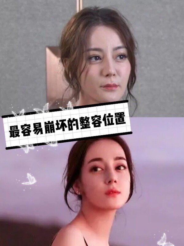 首页 此页面仅支持预览 Avatar Miiisto 432篇日记 整容这个位置容易崩坏 年龄不大就显老 我对整容脸的定义是 整形痕迹不自然的脸 而整容的最高境界 是保留个人特色 根据个人审美做最大的优化 给人的感觉是 你变美了 而不是 哇 哪整的 不仅是女