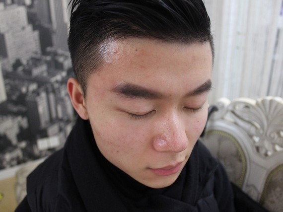 我是94年的,近几年对90的发际线的调侃挺多的,好_圈子-新氧美容整形