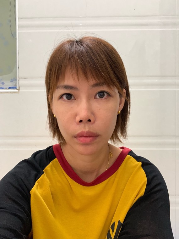 一直以来塌鼻梁,朝天鼻,和又厚又大又凸的嘴巴使我很_圈子-新氧美容